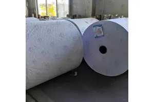 UltraBio™ Basement Membrane Matrix